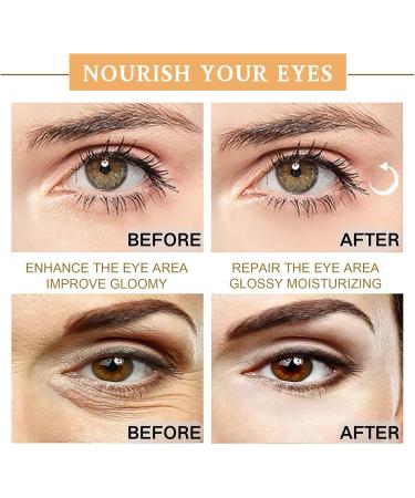 Snail Eye Cream Snail Eye Cream for Dark Circles and Puffy Eyes Eye Bags Remover Eye Cream Anti aging Under Eye Cream Reduce Lines Wrinkles Puffiness and Dark Circles for All Skin Types - Buy Online on GoSupps.com