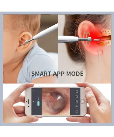 Wireless Ear Wax Removal Kit | 1080P HD Ear Scope Camera | 6 LED Lights | Waterproof | Compatible with iPhone & Android | White - Buy Online on GoSupps.com