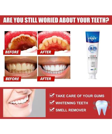 2 PCs Smile Doctor SP-4 Probiotic Whitening Toothpaste | 2024 Ultra Brightening & Fresh Breath Stain Removal - Buy Online on GoSupps.com