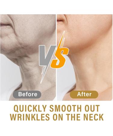 Neck Wrinkle Patches Neck Lift Tape Neck Firming and Tightening Revitalize Neck Wrinkles - Buy Online on GoSupps.com