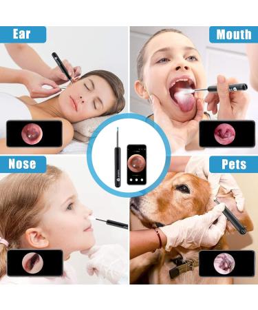Ear Wax Removal Endoscope | BEBIRD HD Earwax Remover Tool with WiFi Camera & LED Lights | USB Rechargeable Ear Cleaner for Kids Adults & Pets - Compatible with iPhone iPad Android (Black - Buy Online on GoSupps.com