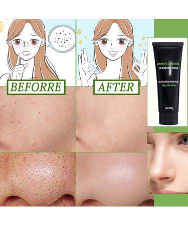 Blackhead Remover Mask | Activated Charcoal Peel Off Face Mask | Deep Cleansing & Purifying for All Skin Types - Buy Online on GoSupps.com