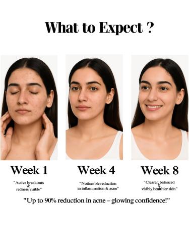 Ewela Blemish Drying Lotion - Overnight Spot Care with Salicylic Acid Calamine Zinc Oxide & Tea Tree - Pink Bi-Phase Formula for Oily & Sensitive Skin - Soothes Redness & Surface Impurities (30ml) - Buy Online on GoSupps.com