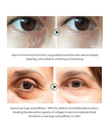 Sonew Snail Essence Eye Cream 20ML - Anti-Wrinkle, Dark Circles & Puffiness Treatment - Buy Online on GoSupps.com