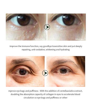 Best Anti-Aging Eye Cream for Dark Circles & Puffiness - 20ml Eye Contour Treatment - Buy Online on GoSupps.com
