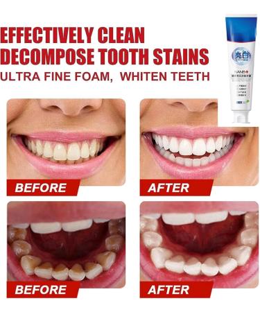 SP-4 Probiotic Rapid Whitening Toothpaste - Ultra Whitening Stain Removal & Fresh Breath | 1PC - Buy Online on GoSupps.com