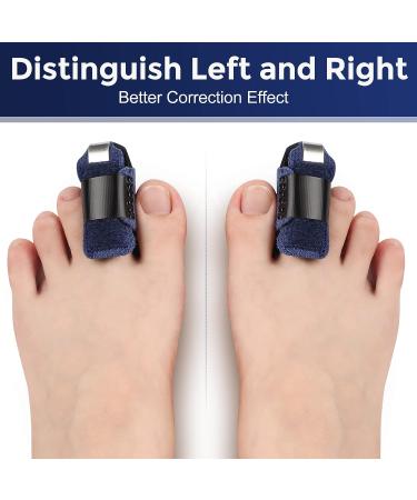Ajoysoul Toe Splint: 1 Pair Toe Straightener for Bent, Hammer, Crooked, Claw Toes - Blue - Buy Online on GoSupps.com