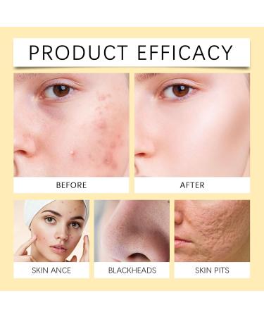 Honey Foaming Facial Cleanser - Gentle Cleansing Hydrating & Oil-Control Face Wash Reduces Acne & Blackheads For Healthy Skin(1PCS) - Buy Online on GoSupps.com