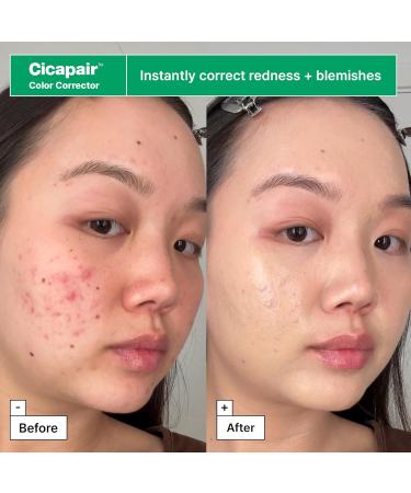 Dr. Jart+ Cicapair Soothing Color Correcting Treatment SPF 30 with Centella Asiatica Extracts | cc cream | Korean Skin Care Cicapair Redness Rescue Set - Buy Online on GoSupps.com