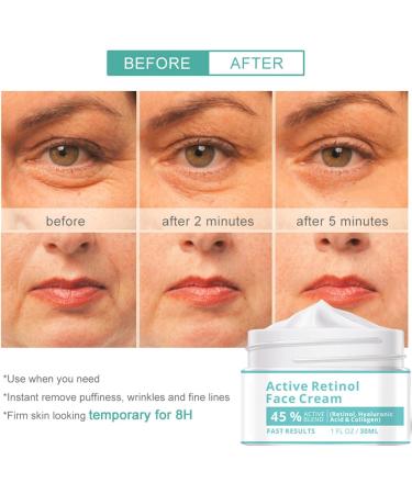  Generisch face moisturizer for women face moisturizer natural face moisturizer 30ml soothing cream for dry sensitive skin - Buy Online on GoSupps.com