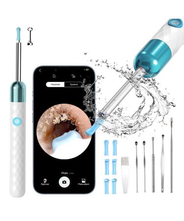Ear Wax Removal Tool Camera for Kids Earwax Removal kit Otoscope with Light 1080P HD Camera Ear Cleaning for Adults WiFi Connected Ear Camera for iPhone iPad Android Phones endoscopic,Rocason White
