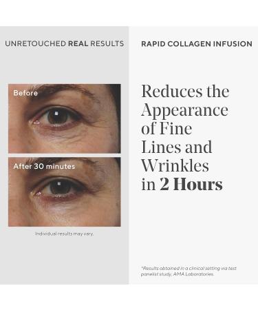 Murad Rapid Collagen Infusion - Anti-Aging Skin Smoothing Cream for Deep Wrinkles - Resurgence Treatment 1.0 Oz - Shop Internationally - Buy Online on GoSupps.com