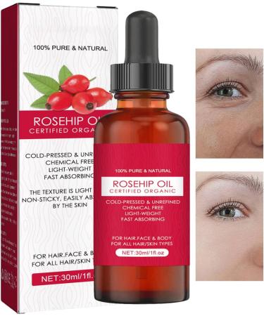 JINGAN Rosehip for Face | Organic Cold Pressed Rosehip 30ML Moisturizing Facial Oil for Face Body Mature Skin Care - Buy Online on GoSupps.com