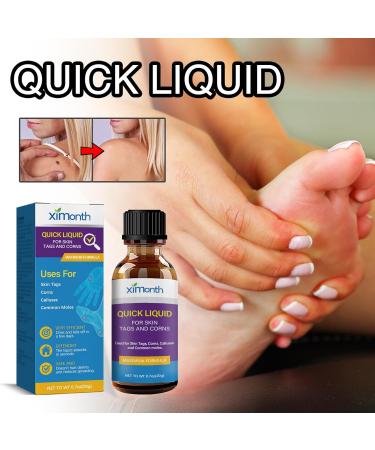 Wart Remover Liquid Fast Acting Salicylic Liquid to Remove Common and Plantar Warts Flat Warts 0.7 Fl Oz 1 Count - Buy Online on GoSupps.com