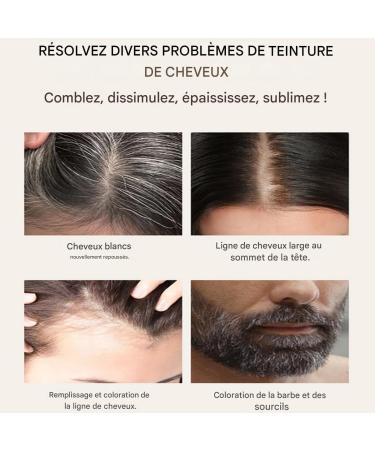  Arrovarp Hair Line Powder For Women - Long Lasting Coverage Concealer Line Men's Hair Instant Light Roots Concealer For Thick And Dense Look | Instant Look Thicker And Thicker - Buy Online on GoSupps.com