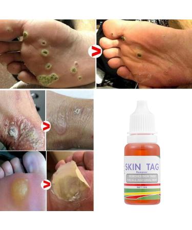 Bleed Bleach - 25g Blemish Corrector Liquid Solution | Beauty Grain Removal Solution | For Women At Home Travel Daily Routine So - Buy Online on GoSupps.com