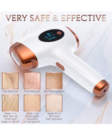 Aopvui At-Home IPL Hair Removal - Permanent Laser Hair Removal with 999900 Flashes for Women and Men - Facial Legs Arms Whole Body Treatment - Buy Online on GoSupps.com