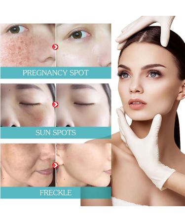  Eastuy 10 x Niacinamide Essence 30 ml Meticulous Brightening Essence for Pores Skincare Essence with Light Texture Suitable for Bleaching Skin Firming - Buy Online on GoSupps.com