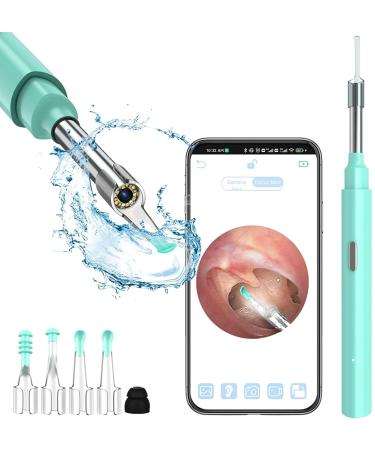 QDCFY OTOSKOK Endoscopic camera tool for removing ear wax wireless otoscope with LED light for iPhone iPad and Android smartphone (black) pink