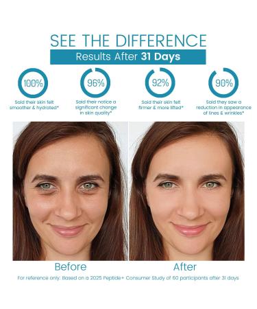 Retinol and Collagen Face Cream, Moisturizer with Hyaluronic Acid & Caffeine, Improves Skin Elasticity, Repairs Barrier, Promotes Collagen Synthesis, Anti Aging, Reduces Wrinkles & Spots, 50g/1.764oz - Buy Online on GoSupps.com