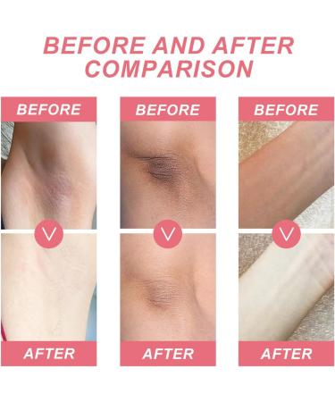 Armpit Whitening Cream Whitening Gel For Underarm Whitening Products Milk Extract & Collagen Skin Whitening Cream Skin Lightening Cream For Knee Legs Armpit Underarm Body 50ml - Buy Online on GoSupps.com