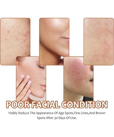 Pure Kojic Acid Skin Brightening Soap Even Tone Cleansing Face and Body Bar for Glowing Skin Moisturizing Sun Damage Skin with Tea Tree Coconut Oil Vegan Paraben-Free - Buy Online on GoSupps.com