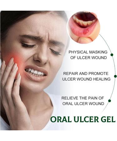 2pcs Mouth Ulcer Spray Mouth Ulcer Treatment Spray Canker Relief Spray Oral Ulcer Sprays Herbal Mouth Spray to Reduce Bad Breath Canker Sore Treatment Ulcer Breath Sprays Mouth Freshener Spray - Buy Online on GoSupps.com