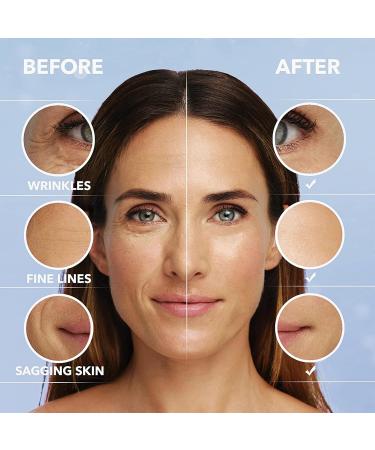 Argireline Solution 10% Anti Wrinkle Serum - Anti Aging Serum for Face Argireline Serum - Deep Wrinkle Reducer Anti Aging Promote Collagen Peptides Serum for a Revitalized Youthful Glow - Buy Online on GoSupps.com