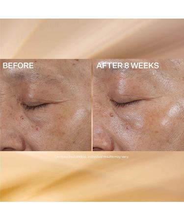 StriVectin Super-C Eye Cream - Brightening & Firming Vitamin C Hyaluronic Acid - International Shipping - 0.51 Oz - Buy Online on GoSupps.com