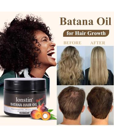 Lonstin Raw Batana Oil for Hair Growth & Repair | Anti Hair Loss Frizz Control Split Ends and Scalp Care for All Hair Types - Buy Online on GoSupps.com