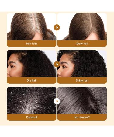 Batana Hair Mask - Batana Oil Hair Mask - 100% Natural - Repair Damaged Hair Nourishes Thin Hair Scalp Skin and Loss Hair Growth Fir for All Hair Types - 50ml - Buy Online on GoSupps.com