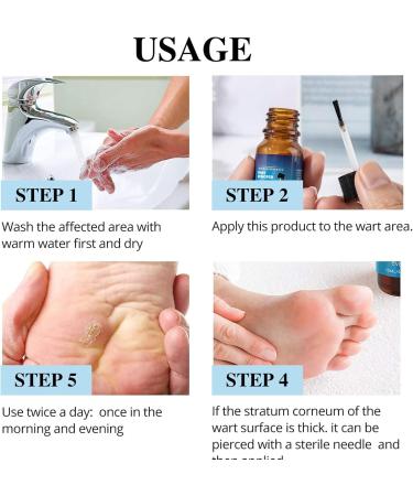 Skin Spot Removal | 10ml Solution for Dissolving Mole Daily Beauty Care for Face Legs Feet Arms Home and Travel Men Women - Buy Online on GoSupps.com