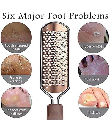 Pedicure Foot File Foot Scraper Foot Pedicure Tool Foot Dead Skin Remover for Pedicure - Buy Online on GoSupps.com