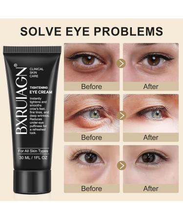 Instant Eye Tightener - Quickly Reduces Dark Circles Eye Bags Puffiness and wrinkles Locks in Moisture - Buy Online on GoSupps.com