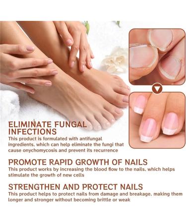 5Pcs 7 Days Nail Growth and Strengthening Serum Nail Serum Repair Essence Nail Growth & Strength Serum Toenail Nail For Repairing Damaged And Discolored Nails 20ml/0.67fl.oz - Buy Online on GoSupps.com