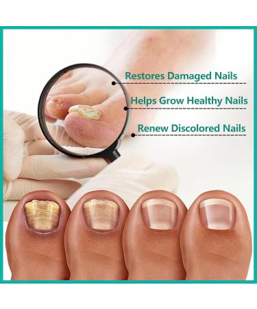 MIELIKKI Nail Repair Cream - Strengthen & Repair Damaged Nails | Nail Strengthener & Solution for Cracked & Discolored Nails - Shop Now - Buy Online on GoSupps.com