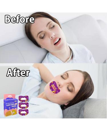 Mouth Tape For Sleeping Quit Mouth Breathing Device Anti Snoring Promotes Nasal Breathing Adhesive Non Woven Fabric Cute Pattern Large Size For Adults 30 Sheets For 30 Days Supply 30 Sheets Forming A New Habit Large Size for Adults - Buy Online on GoSupps.com