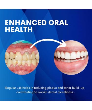 Teeth Whitening Strips for Sensitive Teeth | Best Non-Slip & Non-Toxic Solutions - Shop Now - Buy Online on GoSupps.com