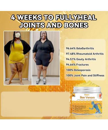 Spzv Bee Venom Joint & Bone Therapy Cream - Muscle & Arthritis Pain Relief (1 Fl Oz) | New Zealand Bee Venom Gel for All Body Parts - Men & Women - Buy Online on GoSupps.com