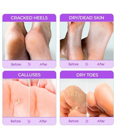 Optimum Foot Peel Mask 4 Pack + Hand Mask | Lavender Callus Eliminator & Cracked Heel Repair - Buy Online on GoSupps.com
