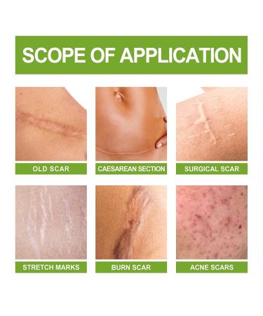 OKATAR Goopgen Advanced Scar Repair Serum - Medical Grade Treatment for Acne, Surgical Scars & Stretch Marks (5pc) - Buy Online on GoSupps.com