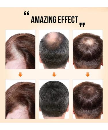 HOVO Multi-Peptide Hair Density Serum | Pure Growth Essence Oil - Buy Online on GoSupps.com