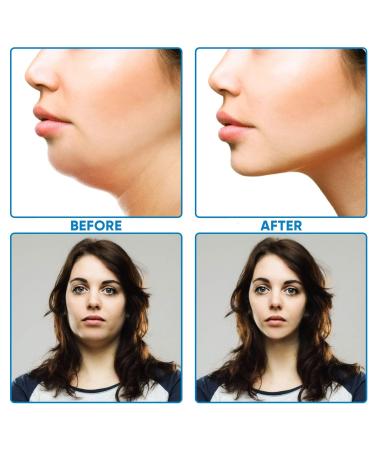 V-Shaped Slimming Face Mask for Women - Double Chin Reducer and Neck Lift Tape - Jawline Sculptor for Firming Skin - 10 and 25 Masks Bundle - Buy Online on GoSupps.com