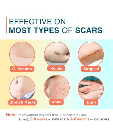 Silicone Scar Sheets 1.5 x 78 Roll - Reusable Medical Scar Tape for C-Section Keloid Stretch Marks & Surgical Scar Removal - Buy Online on GoSupps.com