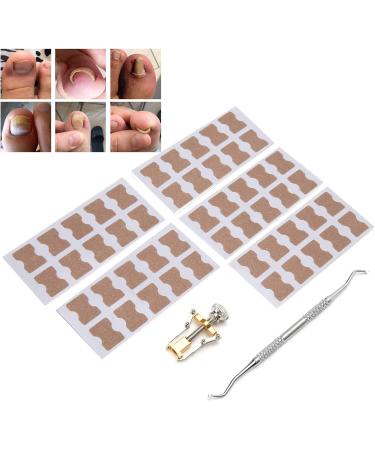 Ingrown Toenail Treatment Ingrown Toenail Corrector Ingrown Toenail Correction Patch Fixer Pedicure Toenail Correction Patch Sticker Foot Care Tool Ingrown Toenail Corrector Strips Foot Care Kit - Buy Online on GoSupps.com
