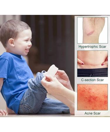 Luqeeg Silicone Scar Sheets - Medical Grade, Reusable Scar Removal Strips for C Section, Surgery, Keloid, Acne - Breathable, Painless Silicone Gel Tape - Washable - 1 Pack - Buy Online on GoSupps.com