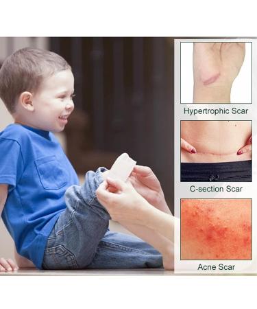 Self-Adhesive Silicone Scar Strips for Acne Scars - Moisturizing & Stretchy Grade A Scar Sheets for Effective Repair - Buy Online on GoSupps.com