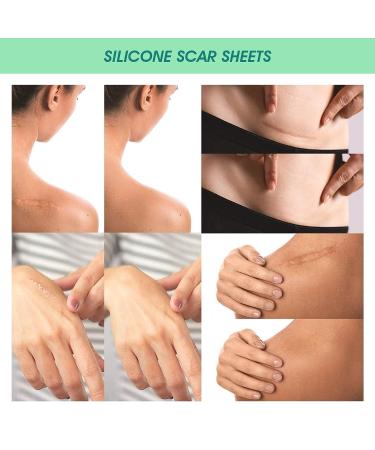Silicone Scar Removal Sheets - C-Section, Surgery, Burns, Acne, Stretch Marks - 4 Sheets - Buy Online on GoSupps.com