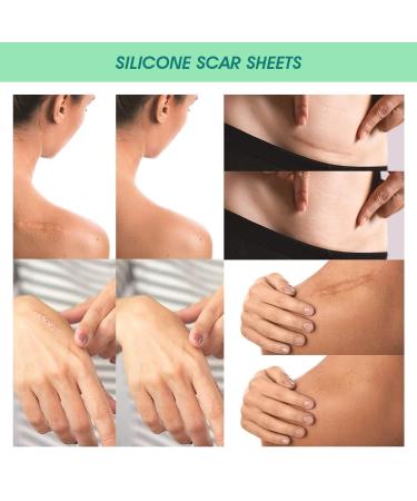 Silicone Scar Sheets - Surgical/Burn Scar Removal Treatment - 4PCs - Buy Online on GoSupps.com