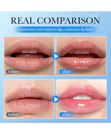 Moisturizing Lip Masks - Sleeping Lip Mask Overnight - Lip Care Lip Repair - Hydrating Lip Balm - Lip Moisturizer for Dry Lips - Day & Night Used - Buy Online on GoSupps.com